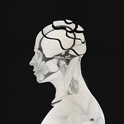 Alzheimer et troubles apparentés